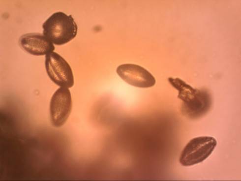 makro pyl.jpg